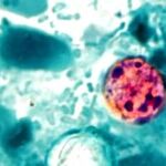 Americans Can't Handle a Diarrhea Apocalypse