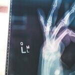 Bone Health Basics