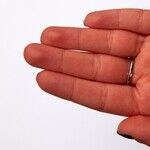 Courage Required: Reporting an Addicted Colleague