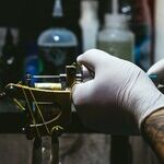 Tattoo Removal Is Expensive