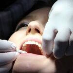 Weird of Mouth