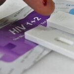 HIV Diminished, but it's not Gone