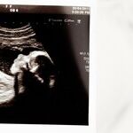 What the Cave Boys Teach Us About Abortion