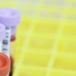 Amid a Dire Blood Shortage, Let Gay Men Donate