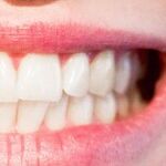 How to Have a Great Smile