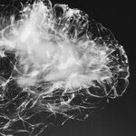Stroke 101: Part 1