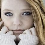 Anxiety Causes Embarrassing Blushing